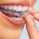 Стоматологи назвали самые главные мифы о зубах